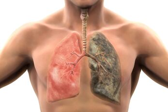 Más de 200 compuestos dañinos envenenan el cuerpo con cada inhalación. 