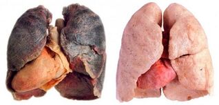 pulmones de fumador y sanos
